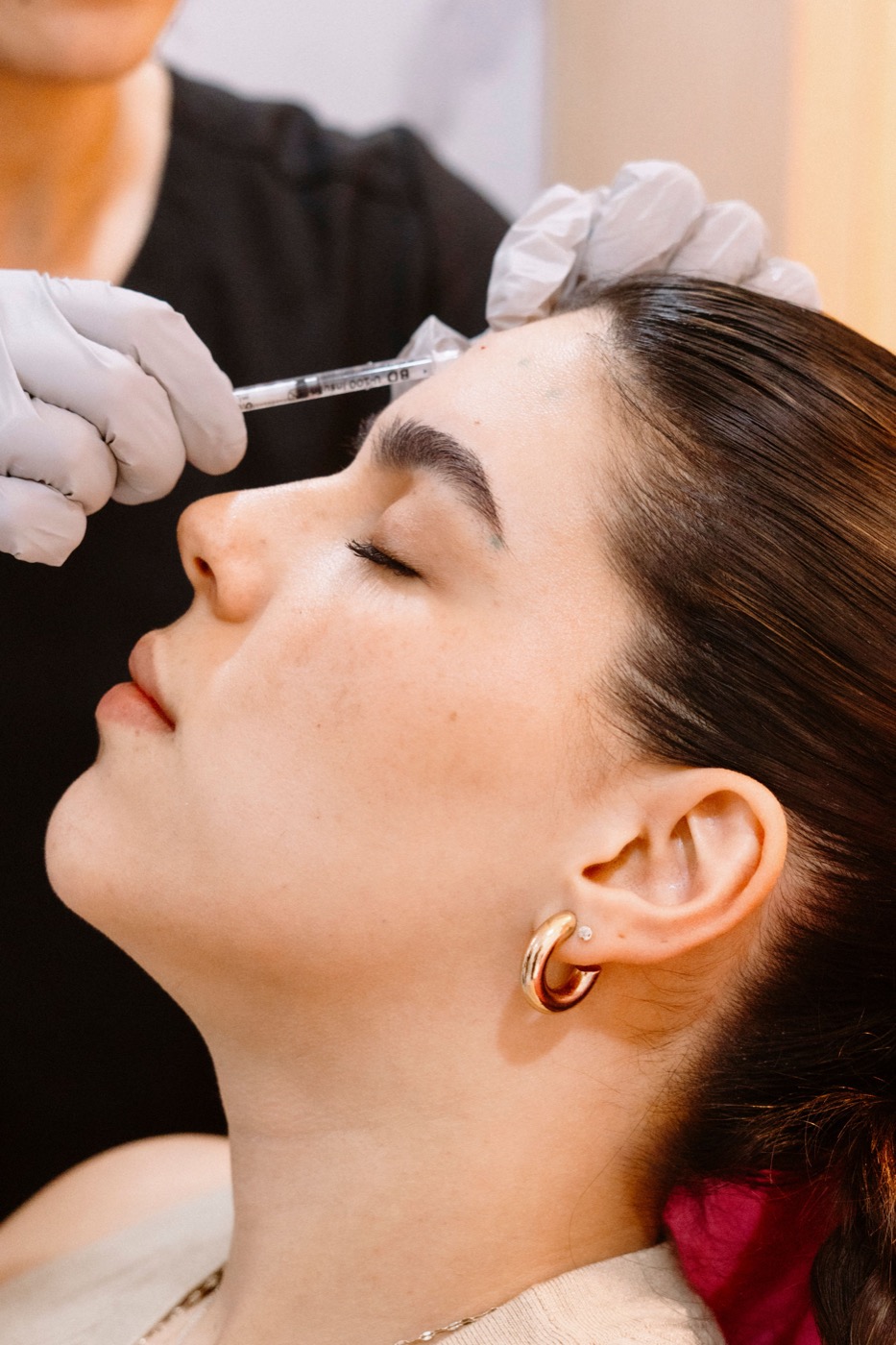 Botox-Behandlung der Stirn bei einer Patientin