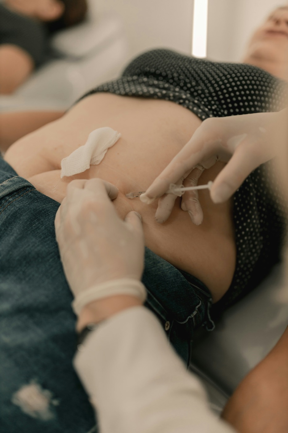 Ärztlich durchgeführte Injektion am Bauch
